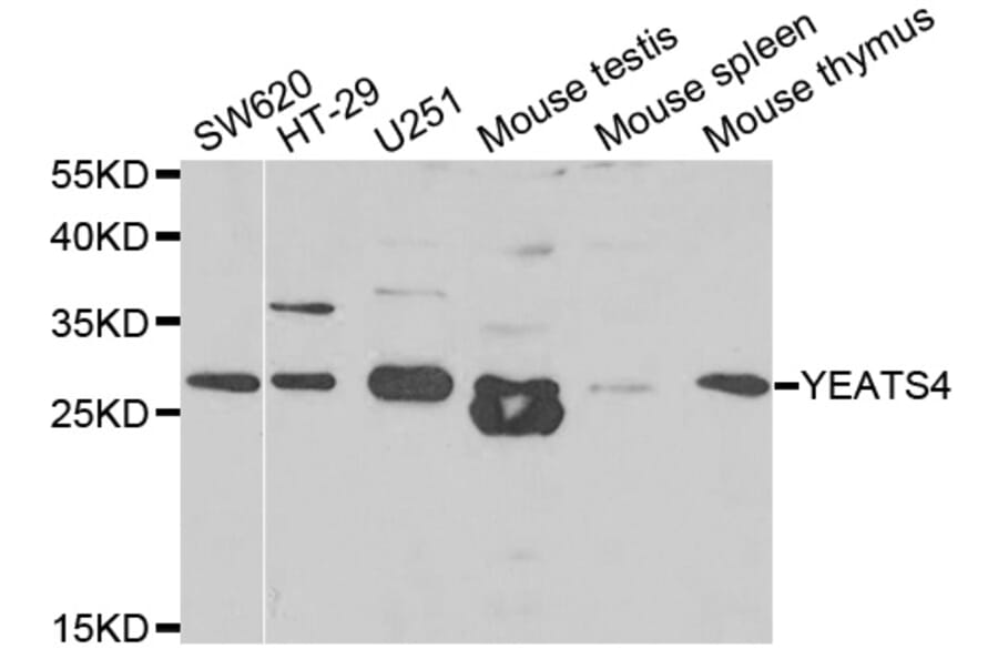 Western blot - YEATS4 antibody from Signalway Antibody (38821) - Antibodies.com