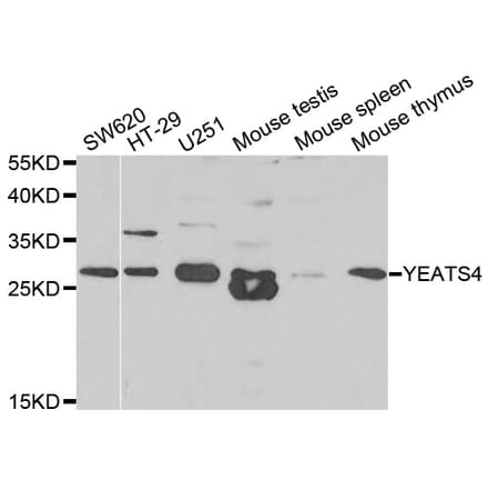 Western blot - YEATS4 antibody from Signalway Antibody (38821) - Antibodies.com