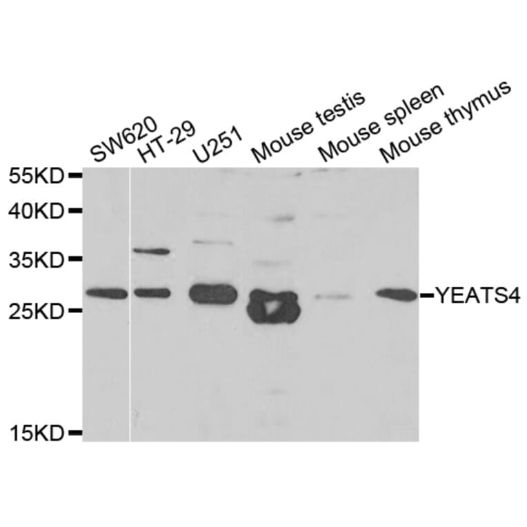 Western blot - YEATS4 antibody from Signalway Antibody (38821) - Antibodies.com