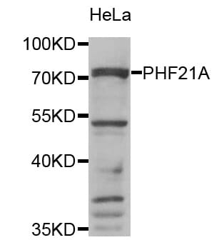 Western blot analysis of extracts of HeLa cell line, using PHF21A antibody.
