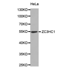 Western blot - ZC3HC1 antibody from Signalway Antibody (38830) - Antibodies.com