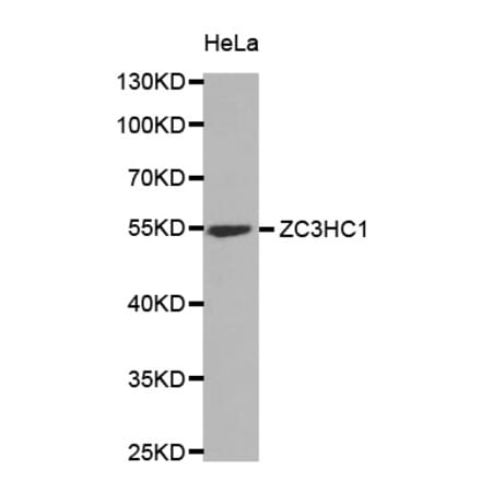 Western blot - ZC3HC1 antibody from Signalway Antibody (38830) - Antibodies.com