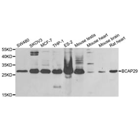 Western blot - BCAP29 antibody from Signalway Antibody (38834) - Antibodies.com
