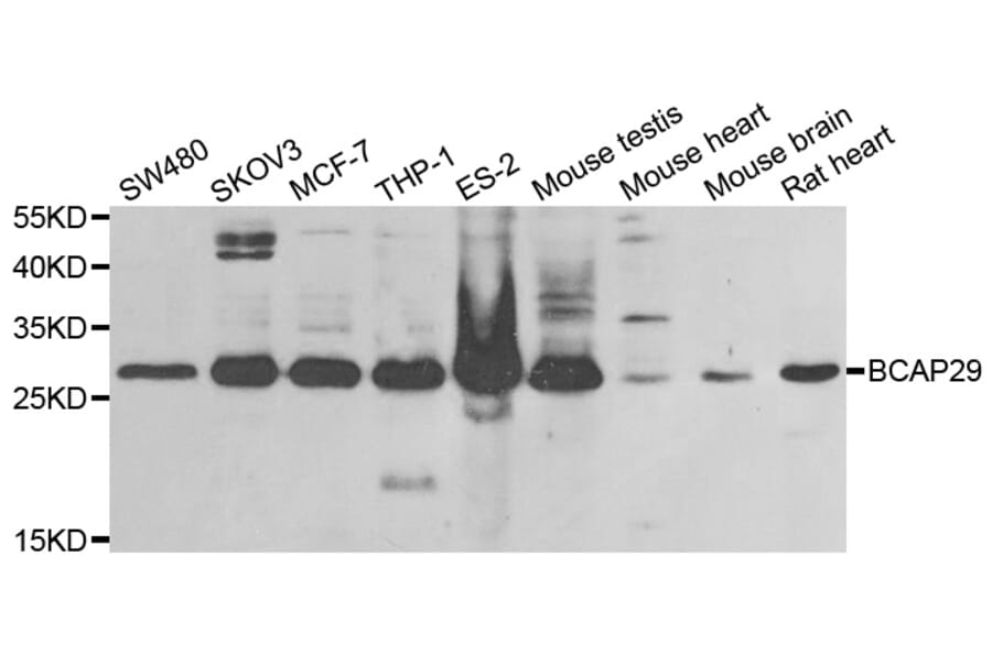 Western blot - BCAP29 antibody from Signalway Antibody (38834) - Antibodies.com