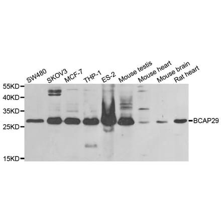 Western blot - BCAP29 antibody from Signalway Antibody (38834) - Antibodies.com