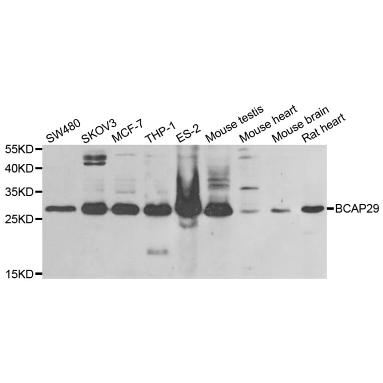 Western blot - BCAP29 antibody from Signalway Antibody (38834) - Antibodies.com
