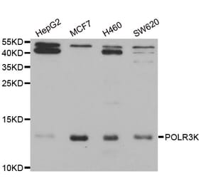 Western blot - POLR3K antibody from Signalway Antibody (38943) - Antibodies.com