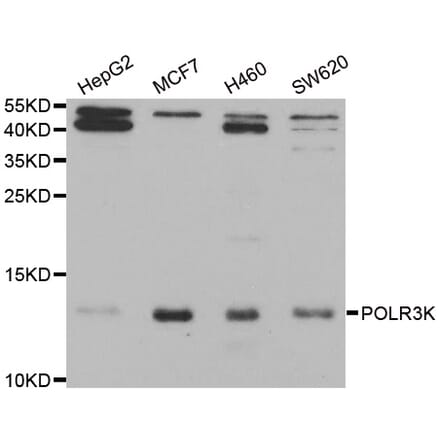 Western blot - POLR3K antibody from Signalway Antibody (38943) - Antibodies.com