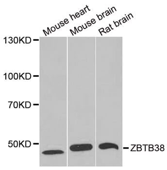 Western blot analysis of extracts of various tissues, using ZBTB38 antibody.