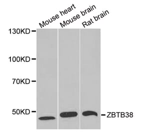 Western blot - ZBTB38 antibody from Signalway Antibody (38964) - Antibodies.com