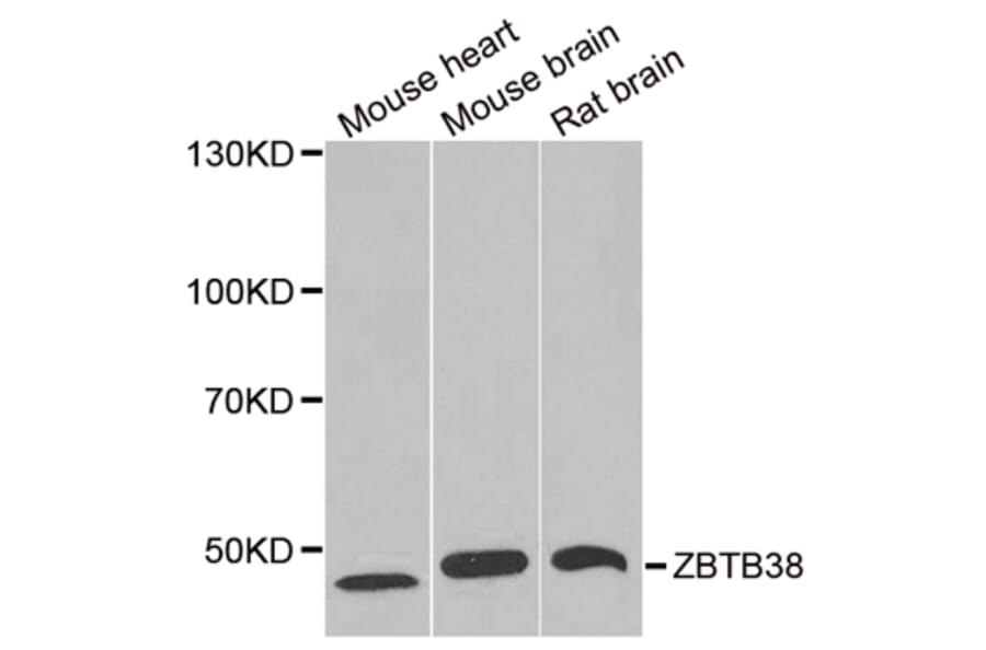 Western blot - ZBTB38 antibody from Signalway Antibody (38964) - Antibodies.com