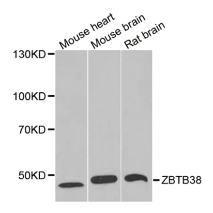 Western blot - ZBTB38 antibody from Signalway Antibody (38964) - Antibodies.com