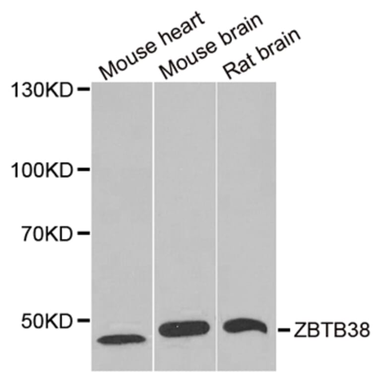 Western blot - ZBTB38 antibody from Signalway Antibody (38964) - Antibodies.com