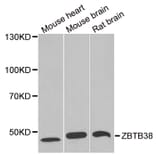 Western blot - ZBTB38 antibody from Signalway Antibody (38964) - Antibodies.com