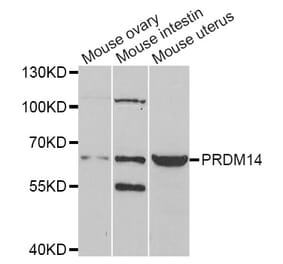 Western blot - PRDM14 antibody from Signalway Antibody (38965) - Antibodies.com
