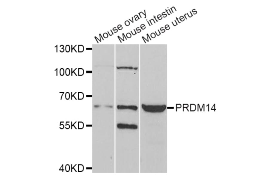 Western blot - PRDM14 antibody from Signalway Antibody (38965) - Antibodies.com