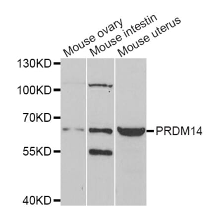 Western blot - PRDM14 antibody from Signalway Antibody (38965) - Antibodies.com