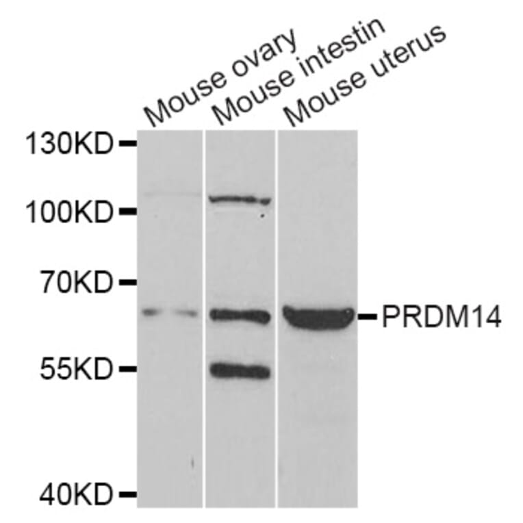 Western blot - PRDM14 antibody from Signalway Antibody (38965) - Antibodies.com
