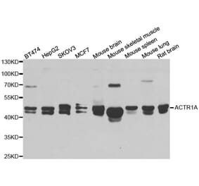 Western blot - ACTR1A antibody from Signalway Antibody (38969) - Antibodies.com