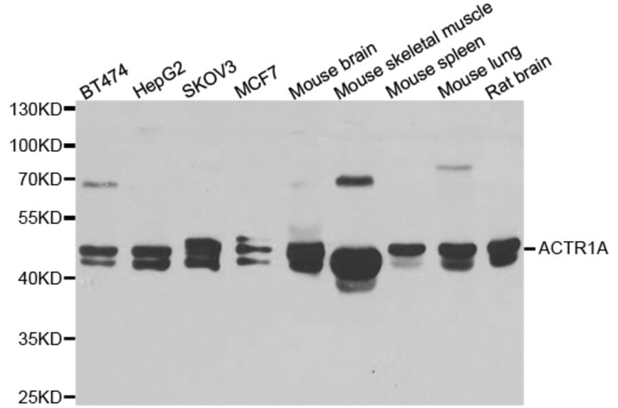 Western blot - ACTR1A antibody from Signalway Antibody (38969) - Antibodies.com