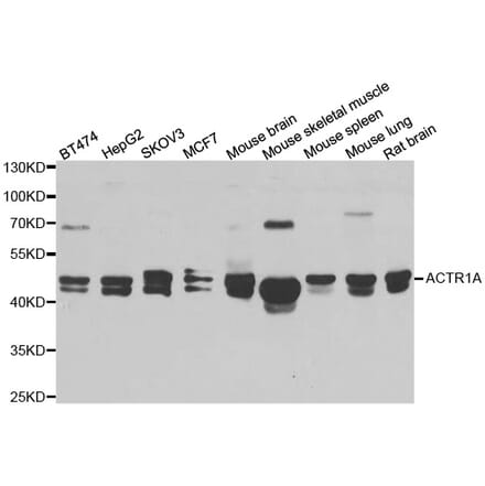 Western blot - ACTR1A antibody from Signalway Antibody (38969) - Antibodies.com