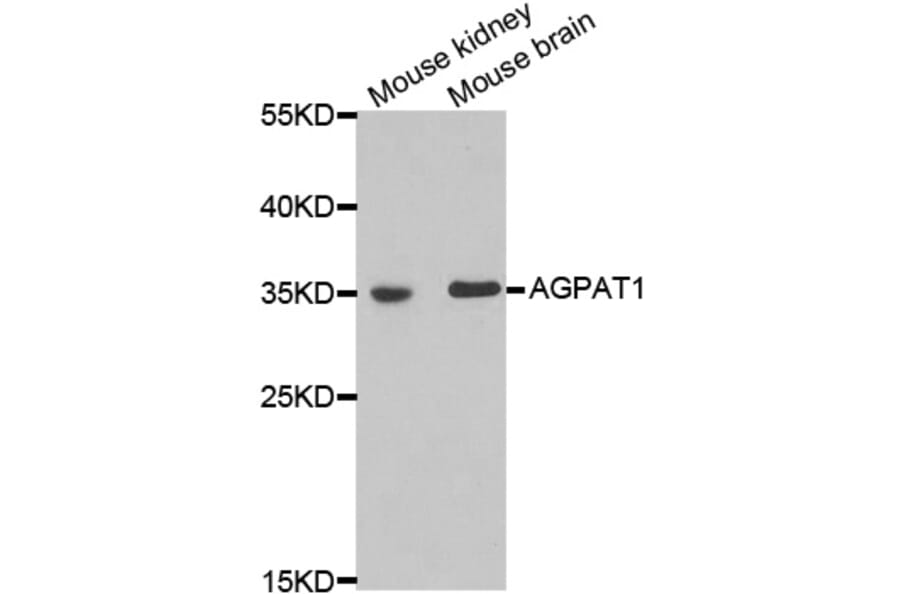 Western blot - AGPAT1 antibody from Signalway Antibody (38971) - Antibodies.com
