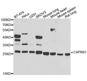 Western blot - CAPNS1 antibody from Signalway Antibody (38992) - Antibodies.com