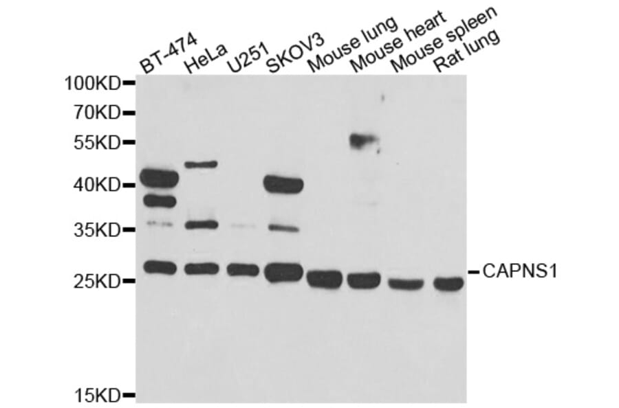 Western blot - CAPNS1 antibody from Signalway Antibody (38992) - Antibodies.com
