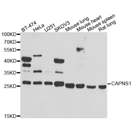 Western blot - CAPNS1 antibody from Signalway Antibody (38992) - Antibodies.com