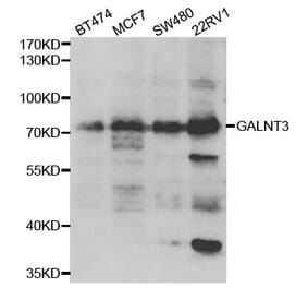Western blot - GALNT3 antibody from Signalway Antibody (39032) - Antibodies.com