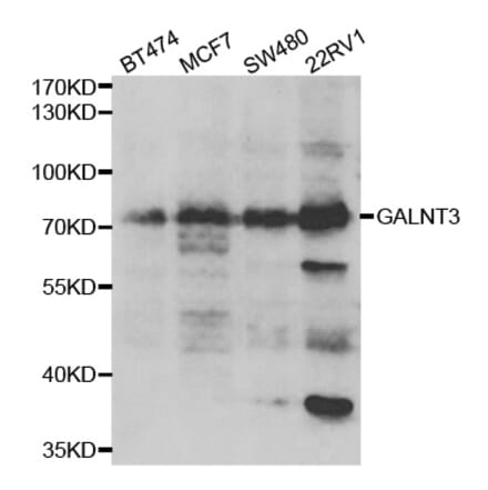 Western blot - GALNT3 antibody from Signalway Antibody (39032) - Antibodies.com