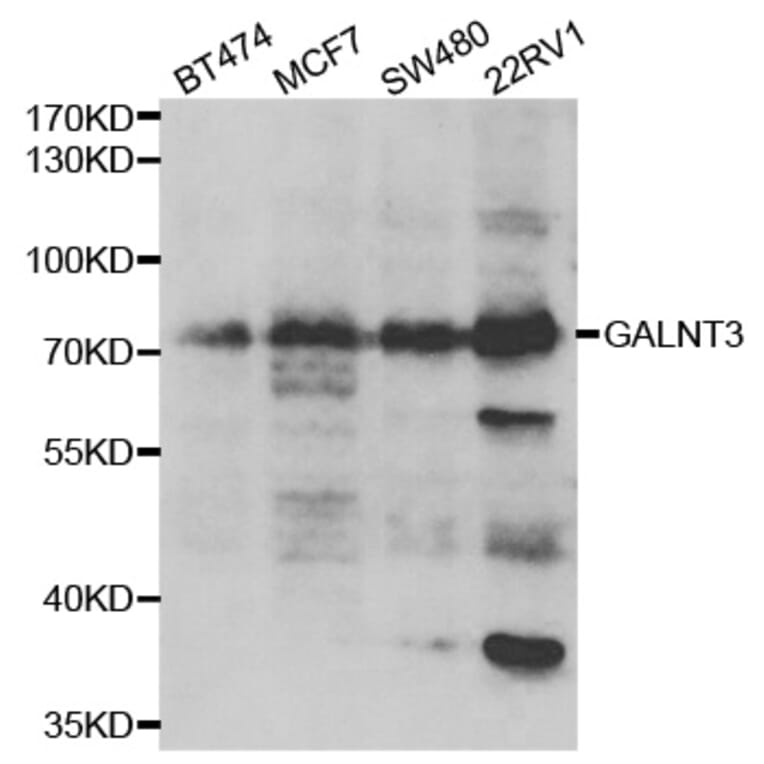 Western blot - GALNT3 antibody from Signalway Antibody (39032) - Antibodies.com