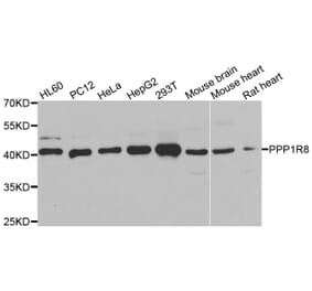 Western blot - PPP1R8 antibody from Signalway Antibody (39114) - Antibodies.com