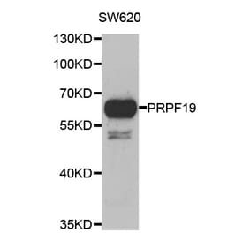 Western blot - PRPF19 antibody from Signalway Antibody (39117) - Antibodies.com