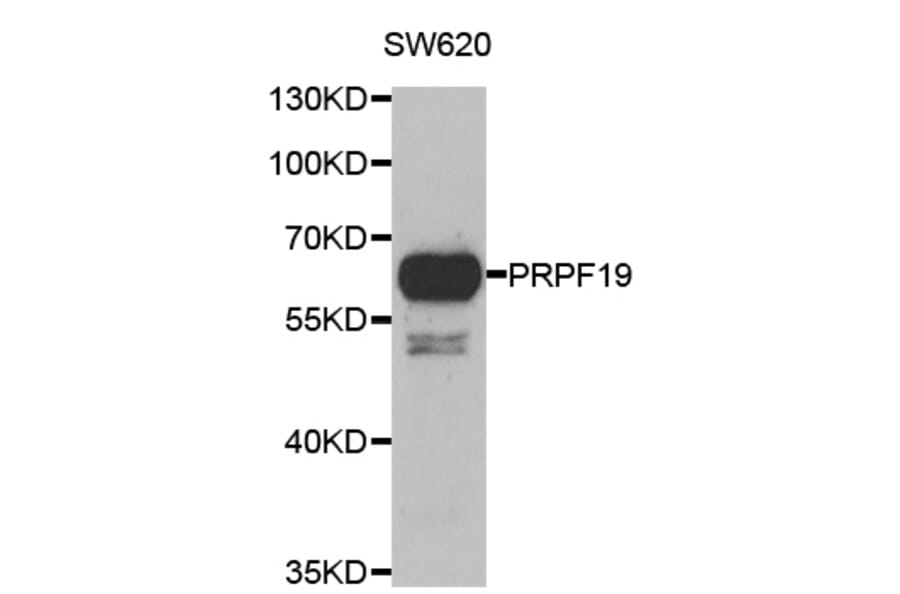 Western blot - PRPF19 antibody from Signalway Antibody (39117) - Antibodies.com