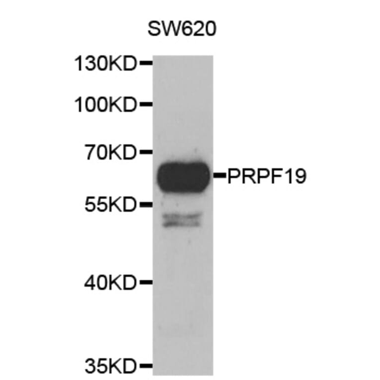 Western blot - PRPF19 antibody from Signalway Antibody (39117) - Antibodies.com