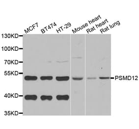 Western blot - PSMD12 antibody from Signalway Antibody (39119) - Antibodies.com