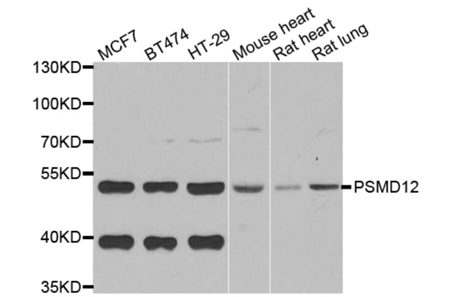 Western blot - PSMD12 antibody from Signalway Antibody (39119) - Antibodies.com