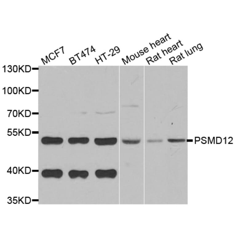 Western blot - PSMD12 antibody from Signalway Antibody (39119) - Antibodies.com