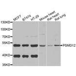 Western blot - PSMD12 antibody from Signalway Antibody (39119) - Antibodies.com