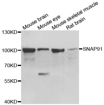 Western blot analysis of extracts of various cell lines, using SNAP91 antibody.