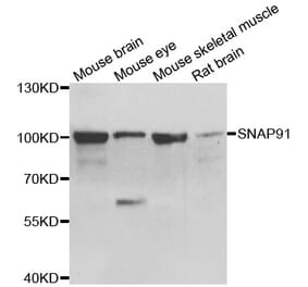 Western blot - SNAP91 antibody from Signalway Antibody (39149) - Antibodies.com