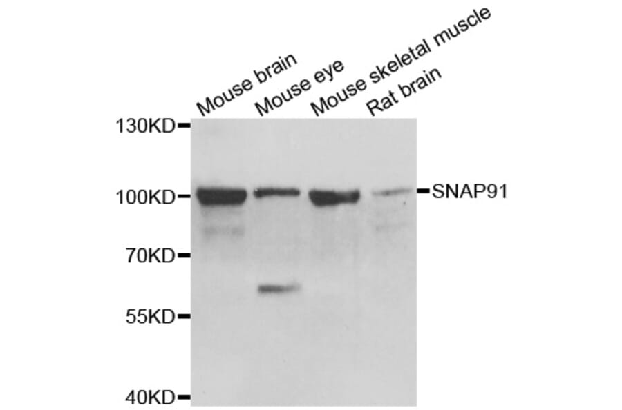 Western blot - SNAP91 antibody from Signalway Antibody (39149) - Antibodies.com