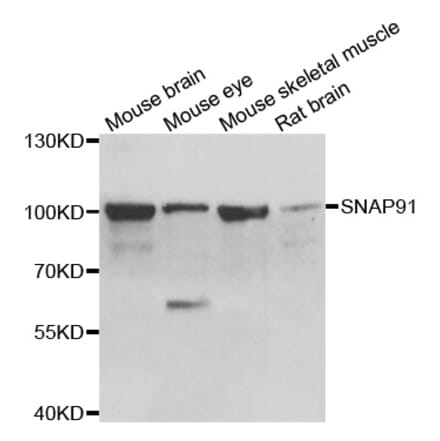 Western blot - SNAP91 antibody from Signalway Antibody (39149) - Antibodies.com