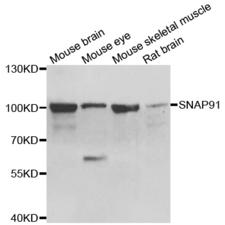 Western blot - SNAP91 antibody from Signalway Antibody (39149) - Antibodies.com