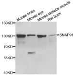 Western blot - SNAP91 antibody from Signalway Antibody (39149) - Antibodies.com
