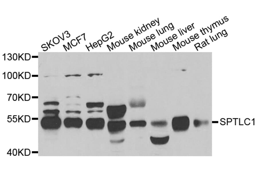 Western blot - SPTLC1 antibody from Signalway Antibody (39151) - Antibodies.com