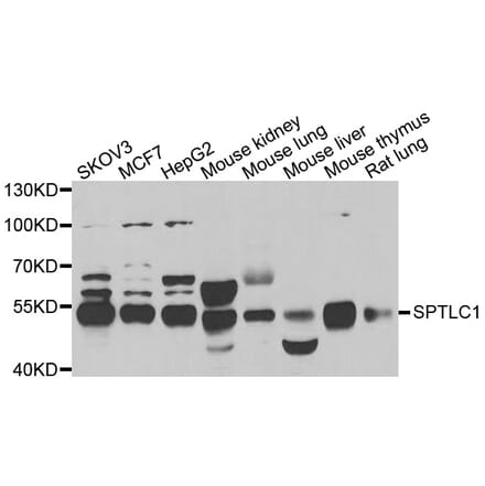 Western blot - SPTLC1 antibody from Signalway Antibody (39151) - Antibodies.com