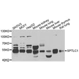 Western blot - SPTLC1 antibody from Signalway Antibody (39151) - Antibodies.com