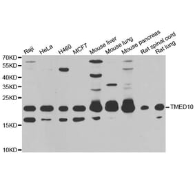Western blot - TMED10 antibody from Signalway Antibody (39167) - Antibodies.com